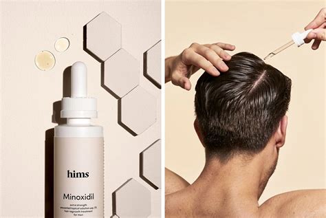 Hims Minoxidil | Hold the Hairline