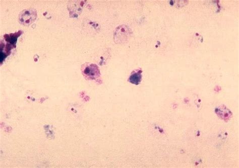 Kostenlose Bild: Plasmodium vivax, gametocyte, reif, trophozoite, Parasiten