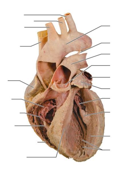 Interior anatomy of the human heart cadaver Diagram | Quizlet