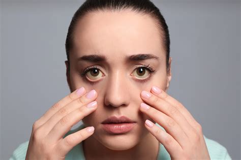 Ptosis: A Comprehensive Guide to Drooping Eyelids – sightconnection