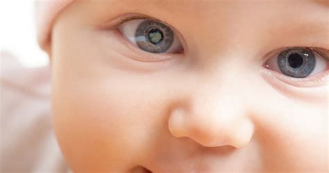 What is Congenital Cataract and when should the infant have the surgery done? | Dr Surabhi Dutt ...