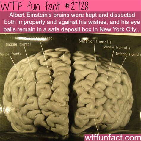 Albert Einstein’s Brains - WTF fun facts