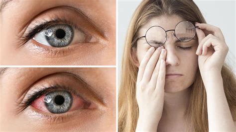 Science Reveals 15 Things That Help Reduce Eye Fatigue