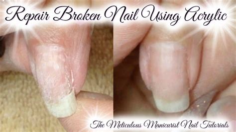 Acrylic Nail Tutorial: How To Repair or Patch Broken Natural Nail - YouTube