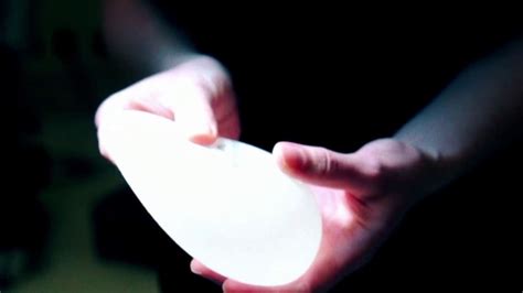 Allergan breast implants linked to cancer recalled after FDA request