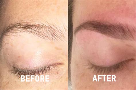 Eyebrow Growth Serum that 100% Works [Customer Reviews] – NourishBrow