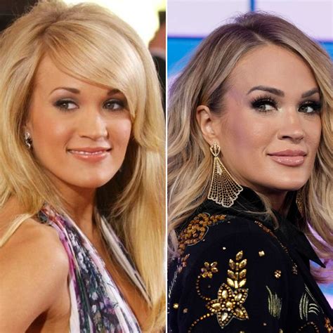 Everything Carrie Underwood Has Said About Plastic Surgery: Photos of the Singer Then and Now