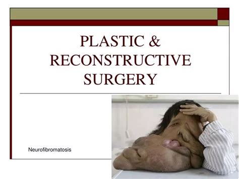 PPT - PLASTIC & RECONSTRUCTIVE SURGERY PowerPoint Presentation, free download - ID:1921818