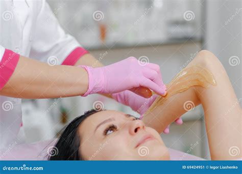 Sugaring: Epilation with Liquate Sugar Stock Image - Image of rejuvenation, medical: 69424951