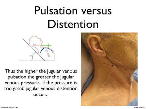 Histology Slides Database: Internal and external jugular vein surface ...