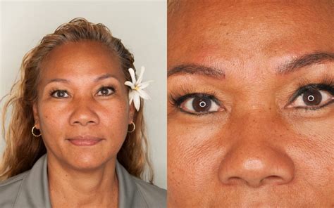 Semi Permanent Makeup Before And After Pictures | Makeupview.co