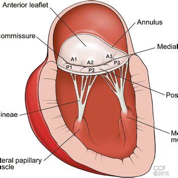 Mitral Valve Anatomy The Mitral Valve Apparatus Is Shown Here With The | My XXX Hot Girl