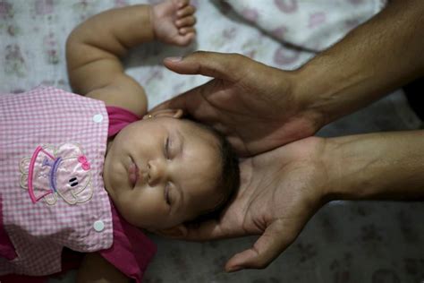 Zika Virus victims: Children born with disorders - Photos,Images ...