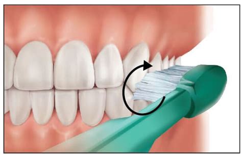 Brushing Techniques - Focus Dentistry
