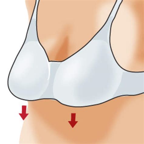 Bras gone bad: 5 signs of an ill-fitting bra - Photo Gallery | BabyCenter