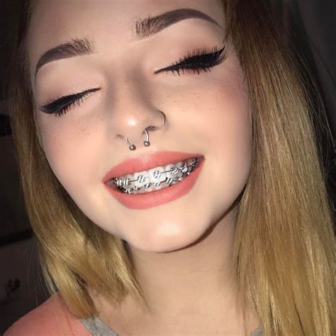 Your favorite brace face #braces #bracesarebeautiful #braceslife #smile #smilemore #happy # ...