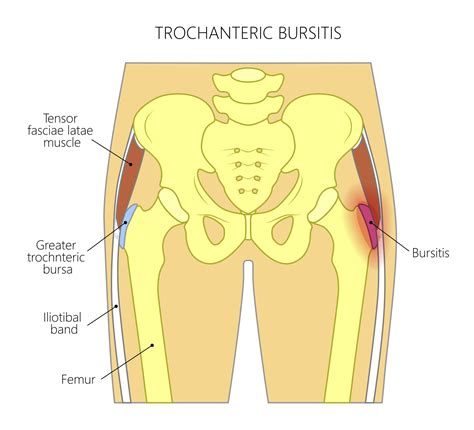 Pin on Exercise