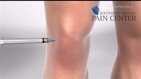 Hyaluronic Injections for Knee Pain at Southern Nevada Pain Center - Southern Nevada Pain Center