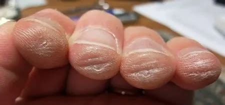 Share 125+ growing nails for guitar super hot - noithatsi.vn