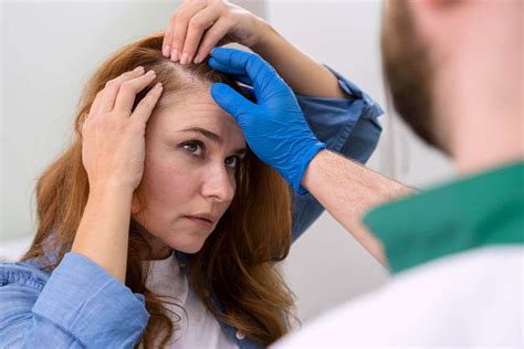 ¿Qué hacer para detener la caída del cabello en mujeres? | Cínica ...