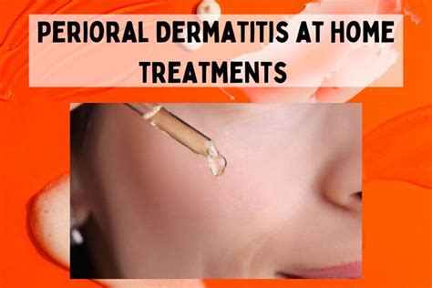 Perioral Dermatitis Self-Care with Over-the-Counter Treatments