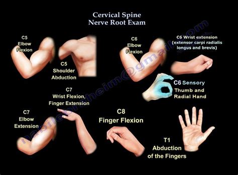 Cervical Spine Nerve Root Exam - Everything You Need To Know - Dr. Nabil Ebraheim | Cervical ...