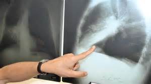 Animelily leaked nude there is a reason I have seen her