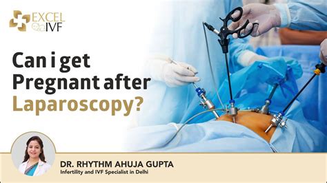 When Can I Have Sex After Laparoscopy Updated Files & Images #652