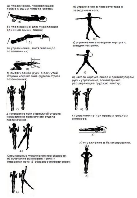 ЛФК при сколиозе: лучшие упражнения, правила гимнастики