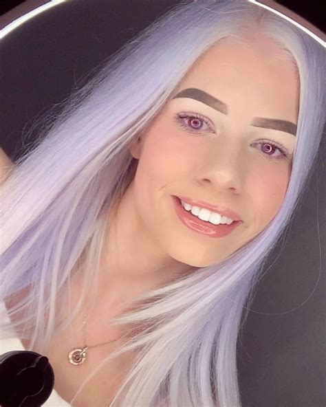 ‘I get bullied and spat on because I’m albino – but I love my rare