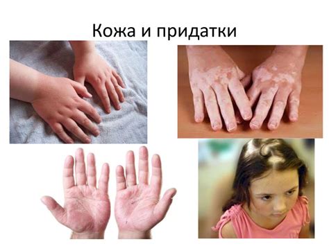 Эндокринология в практике педиатра - презентация онлайн