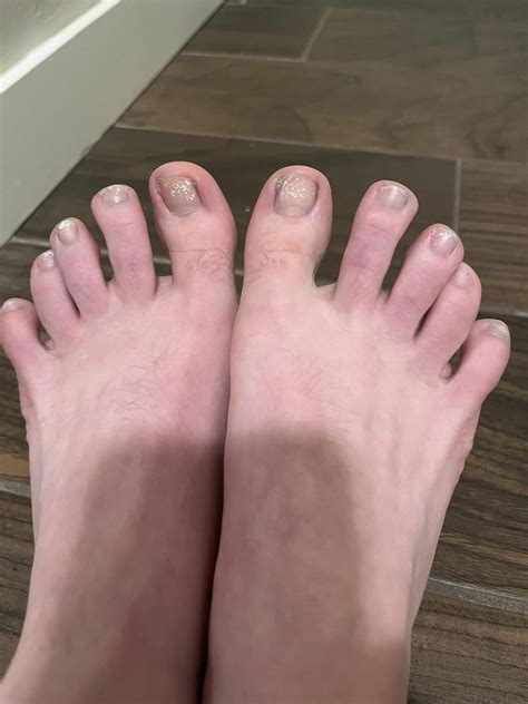 What are these white spots on my toenails? : AskDocs