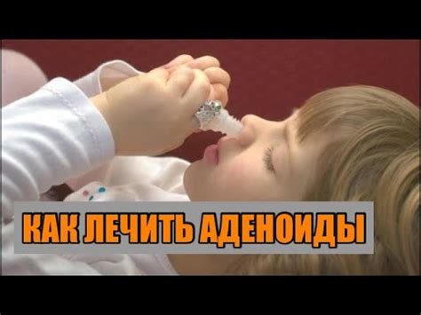 АДЕНОИДЫ. КАК ЛЕЧИТЬ АДЕНОИДЫ - YouTube