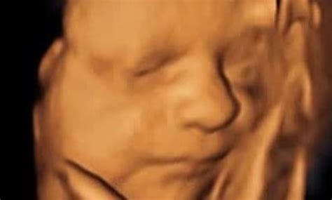 Ultrasound - 4D/5D - 5D ULTRASOUND STUDIO | Groupon
