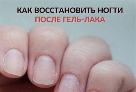 КАК ВОССТАНОВИТЬ НОГТИ ПОСЛЕ ГЕЛЬ-ЛАКА — КАКАО