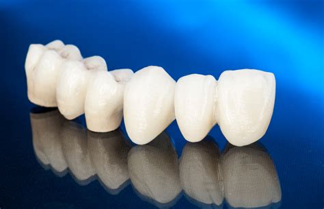 Corone dentali in zirconio e ceramica