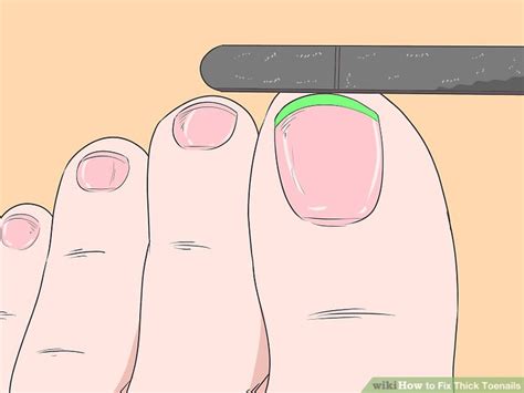 how to fix thick toenails