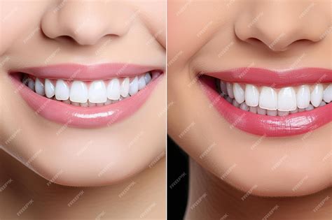 Premium AI Image | Before and after bleaching dental care transforms ...