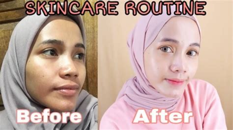 merk skincare  wajah putih bersih  bruntusan wajah