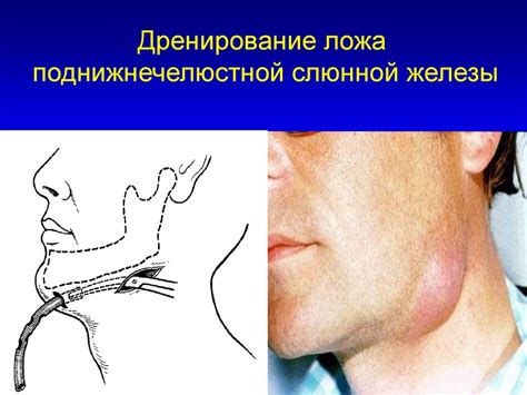 Топографическая анатомия и оперативные вмешательства на голове ...