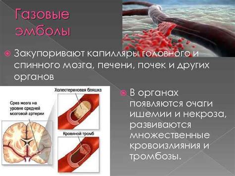ВОЗДУШНАЯ И ГАЗОВАЯ ЭМБОЛИЯ Презентацию выполнила Бедарева М