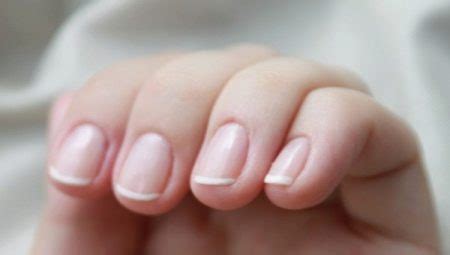 Лечение на възпаление на нокътя кутикула (9 снимки): какво да направя ...