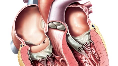 aortic stenosis | University of Utah Health | University of Utah Health