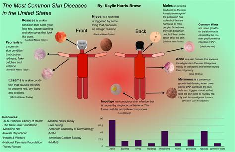 Infographic: The Most Common Skin Diseases in the U.S. – SLI | Skin