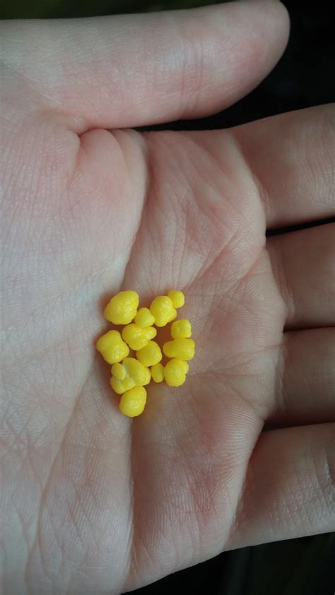 I can never look at yellow Nerds the same way again : r/tonsilstones