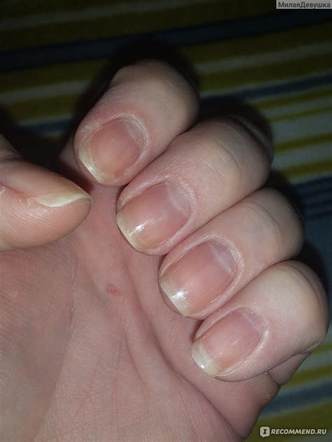 Гель для удаления кутикулы Sally Hansen Instant Cuticle Remover ...