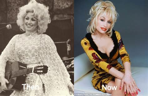 Dolly Parton Explained Why She Never Had Kids Of Her Own Even After Being Married For 5O Years ...