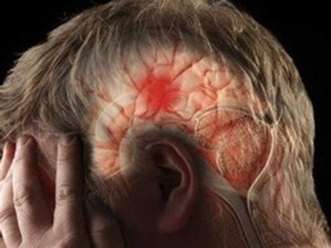 Учени откриха начин за по-бързо проникване на лекарства срещу болестта ...