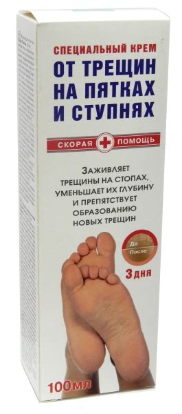 СКОРАЯ ПОМОЩЬ. КРЕМ ДЛЯ НОГ ОТ ТРЕЩИН НА ПЯТКАХ 100МЛ.