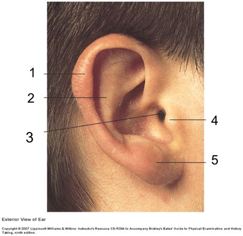 Railroad Track Ears Vs Normal Ears - Hallerenee